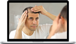 Hypnosis Audios – Cope With Hair Loss